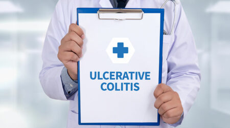 Ulcerative colitis &#8211; Causes, signs, and management options