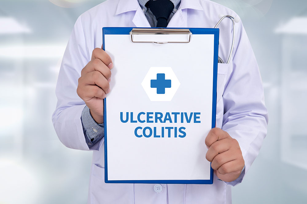 Ulcerative colitis &#8211; Causes, signs, and management options