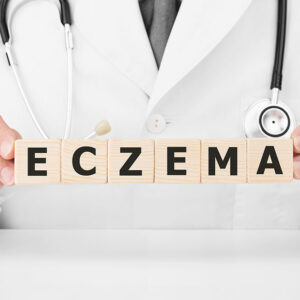 A comprehensive guide to eczema