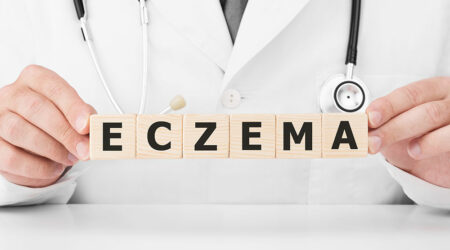 A comprehensive guide to eczema