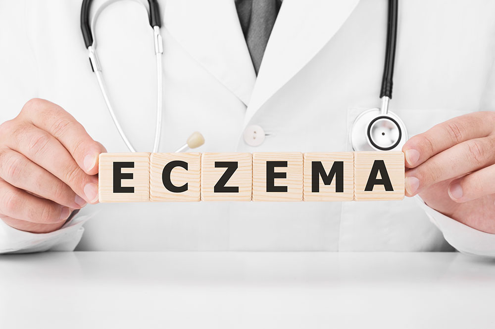 A comprehensive guide to eczema