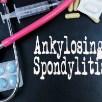 Ankylosing spondylitis &#8211; Causes, symptoms, and management