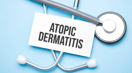 Atopic dermatitis &#8211; Causes, symptoms, remedies, and more