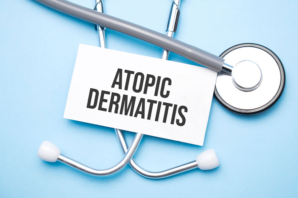 Atopic dermatitis &#8211; Causes, symptoms, remedies, and more