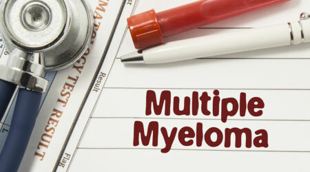 Causes, symptoms, and management of multiple myeloma