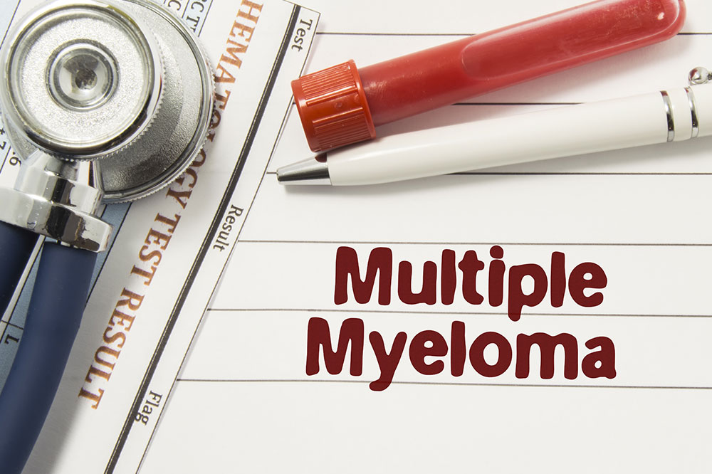 Causes, symptoms, and management of multiple myeloma