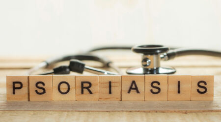 Causes, signs, and more about plaque psoriasis