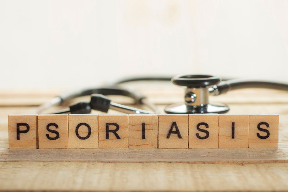 Causes, signs, and more about plaque psoriasis