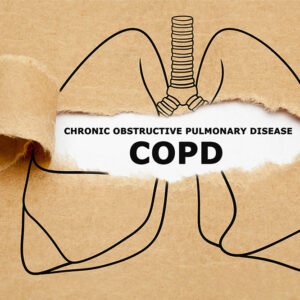 COPD &#8211; Causes, signs, foods to eat, and more