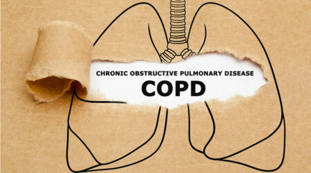 COPD &#8211; Causes, signs, foods to eat, and more