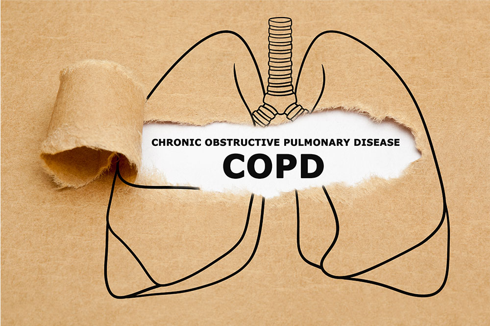 COPD &#8211; Causes, signs, foods to eat, and more