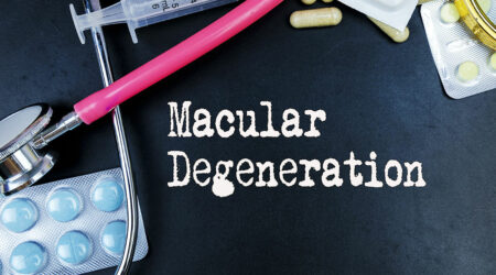 Macular degeneration &#8211; Causes, signs, and management