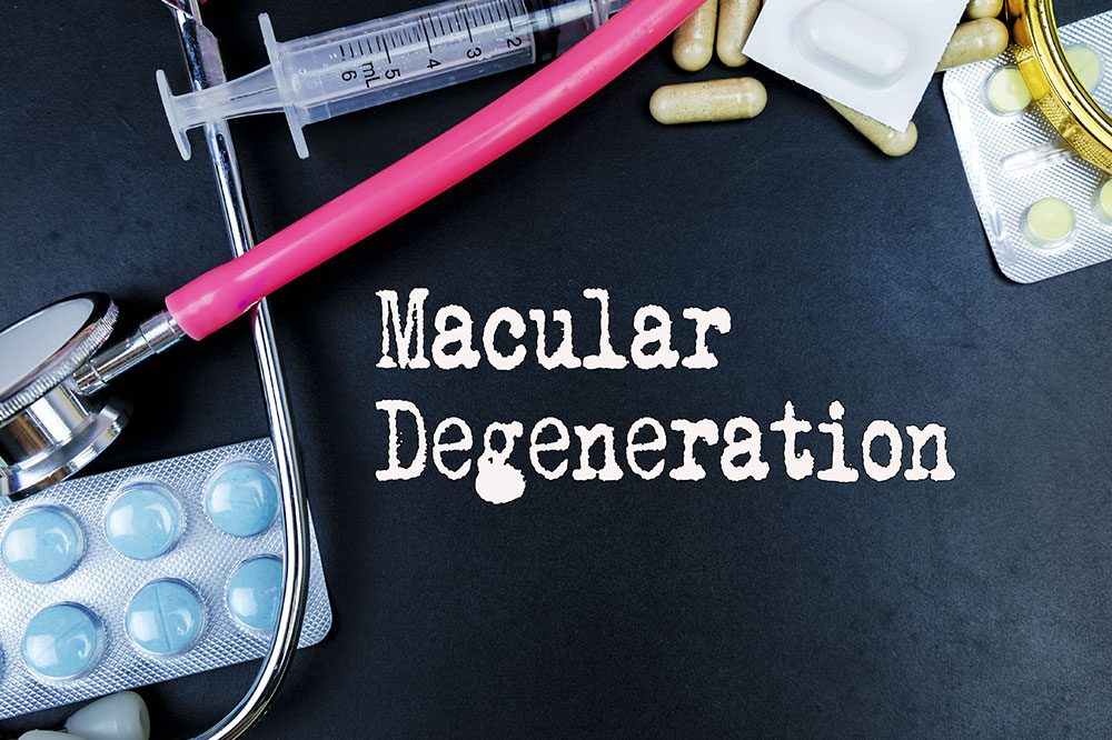 Macular degeneration &#8211; Causes, signs, and management