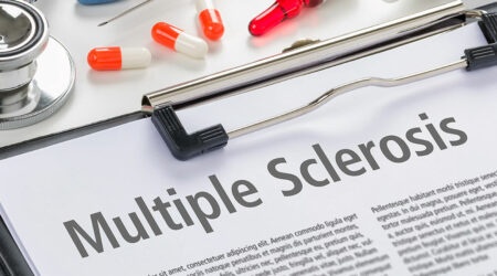 Multiple sclerosis &#8211; Causes, symptoms, and management