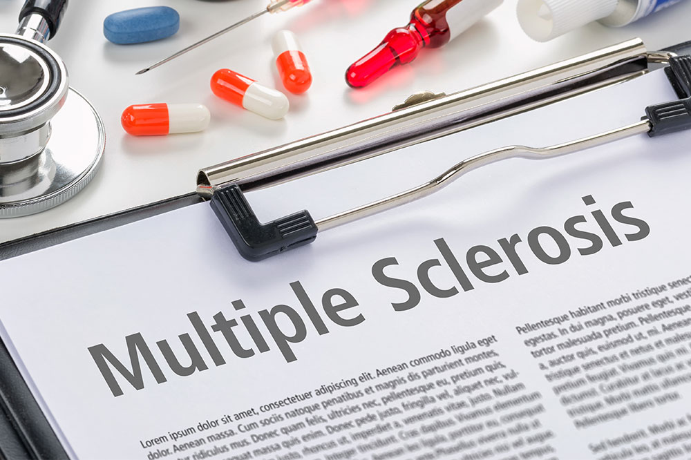 Multiple sclerosis &#8211; Causes, symptoms, and management