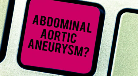 A comprehensive guide to abdominal aortic aneurysm