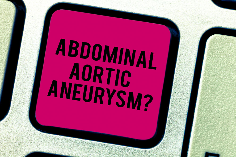 A comprehensive guide to abdominal aortic aneurysm