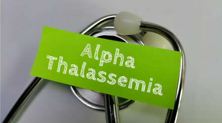 Alpha-thalassemia &#8211; Signs, causes, and management