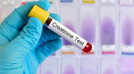 Causes, symptoms, and management of high creatinine