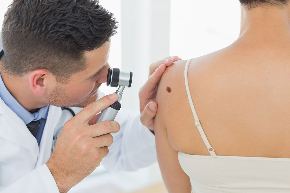 Causes, symptoms, and management options of melanoma