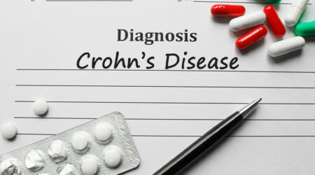 Causes and other vital aspects of Crohn&#8217;s disease