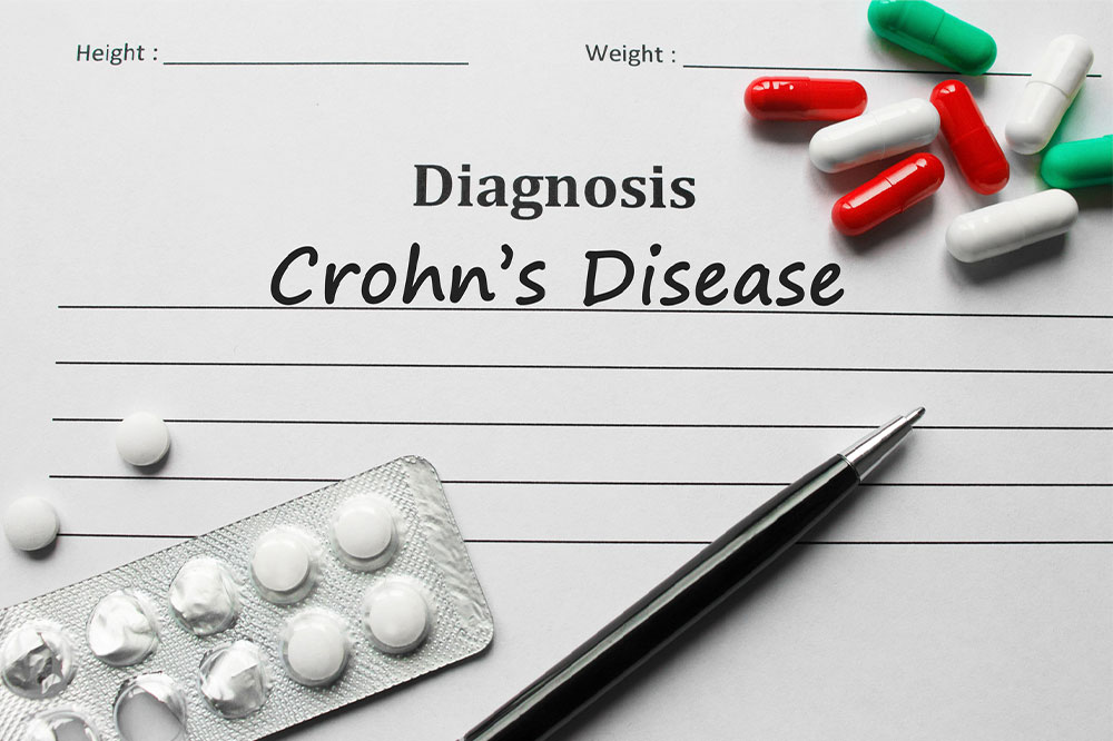 Causes and other vital aspects of Crohn&#8217;s disease