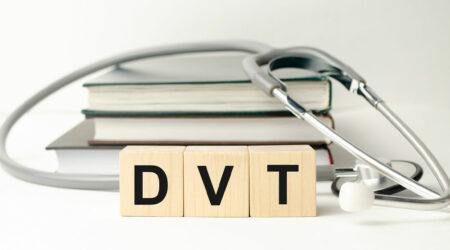 DVT &#8211; Causes, signs, and management options