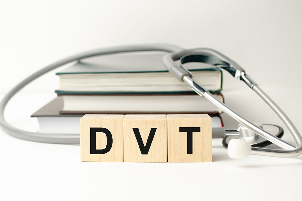 DVT &#8211; Causes, signs, and management options