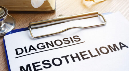 Mesothelioma &#8211; Causes, symptoms, and management