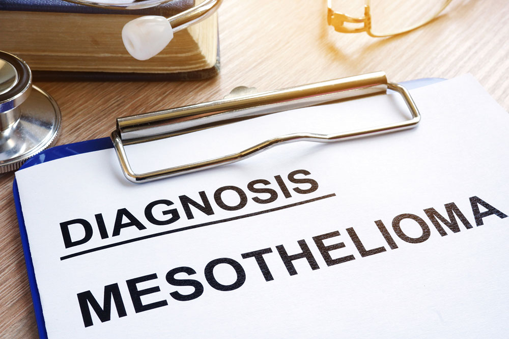 Mesothelioma &#8211; Causes, symptoms, and management