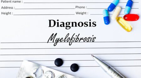 Myelofibrosis &#8211; Its causes, symptoms, and management