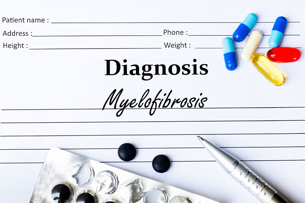 Myelofibrosis &#8211; Its causes, symptoms, and management