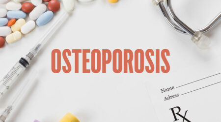 Osteoporosis &#8211; Causes, symptoms, and management