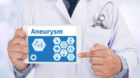 Recognizing the signs and causes of aneurysms