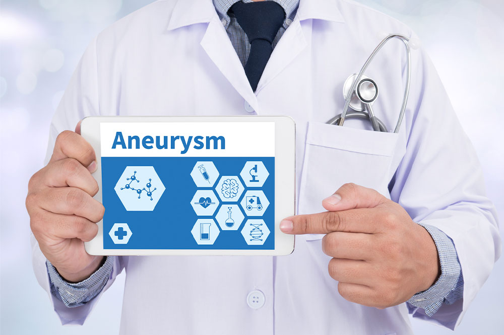 Recognizing the signs and causes of aneurysms