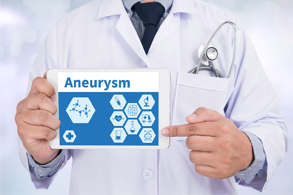 Aneurysms &#8211; Types, symptoms, and management