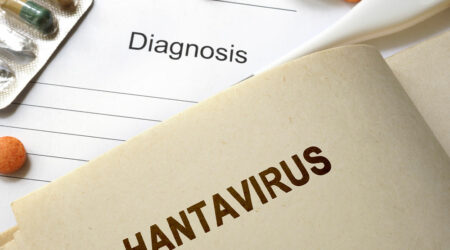 Hantavirus pulmonary syndrome &#8211; Causes, symptoms, and prevention