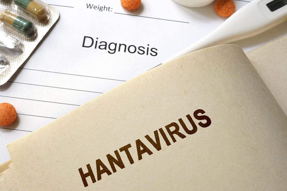 Hantavirus pulmonary syndrome &#8211; Causes, symptoms, and prevention