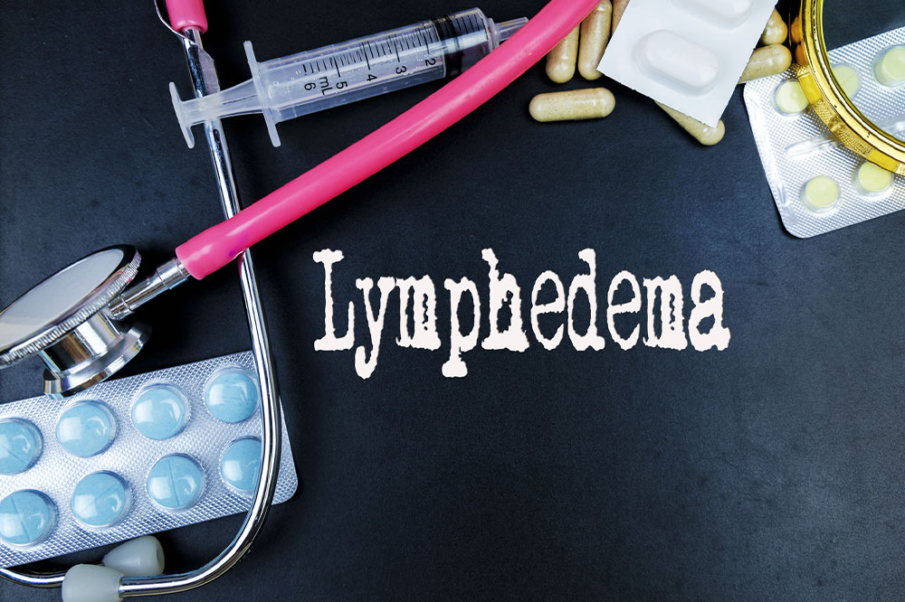 Lymphedema &#8211; Causes, signs, and management options