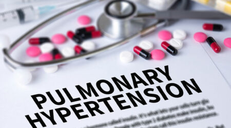 Pulmonary hypertension &#8211; Signs, causes, and management