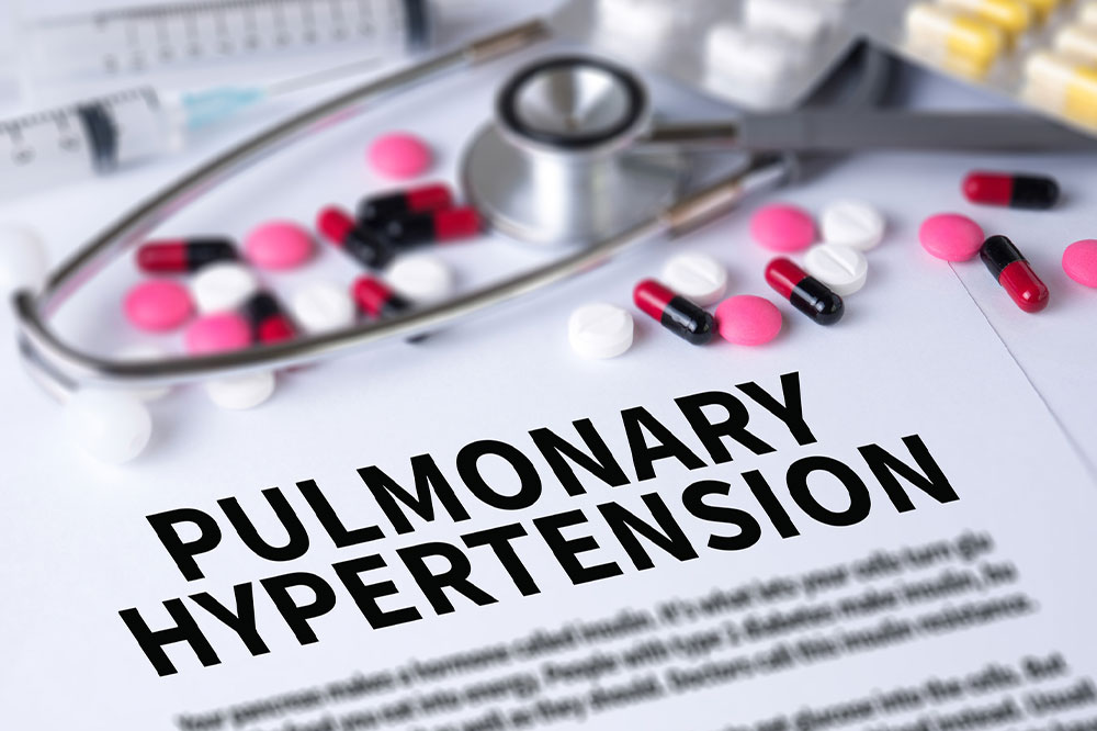 Pulmonary hypertension &#8211; Signs, causes, and management