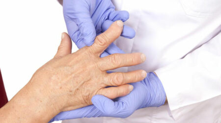 4 best remedies for rheumatoid arthritis