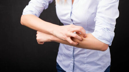 5 effective treatments for atopic dermatitis