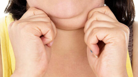 Struggling with a double chin? Here’s how you can get rid of it
