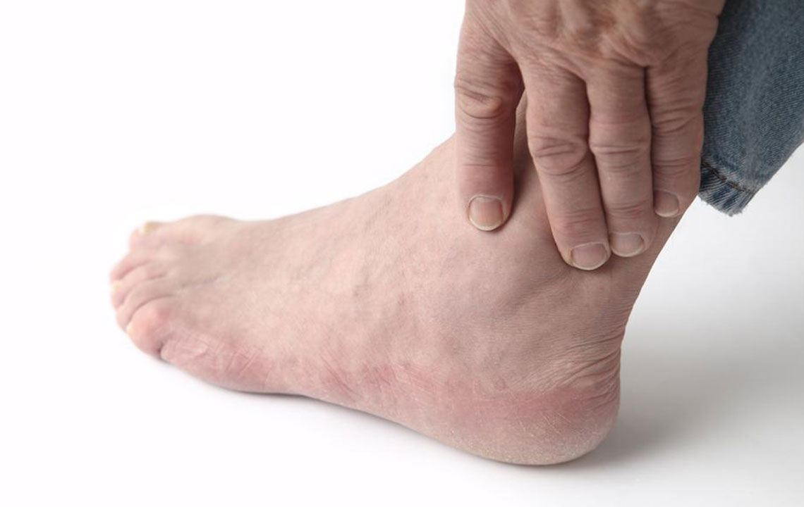 Top Causes of Swollen Ankles