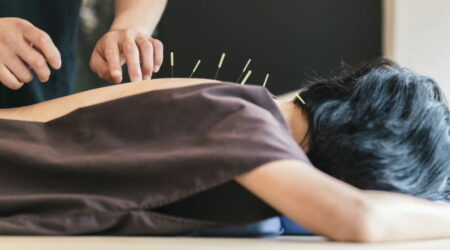 A brief guide to understanding acupuncture