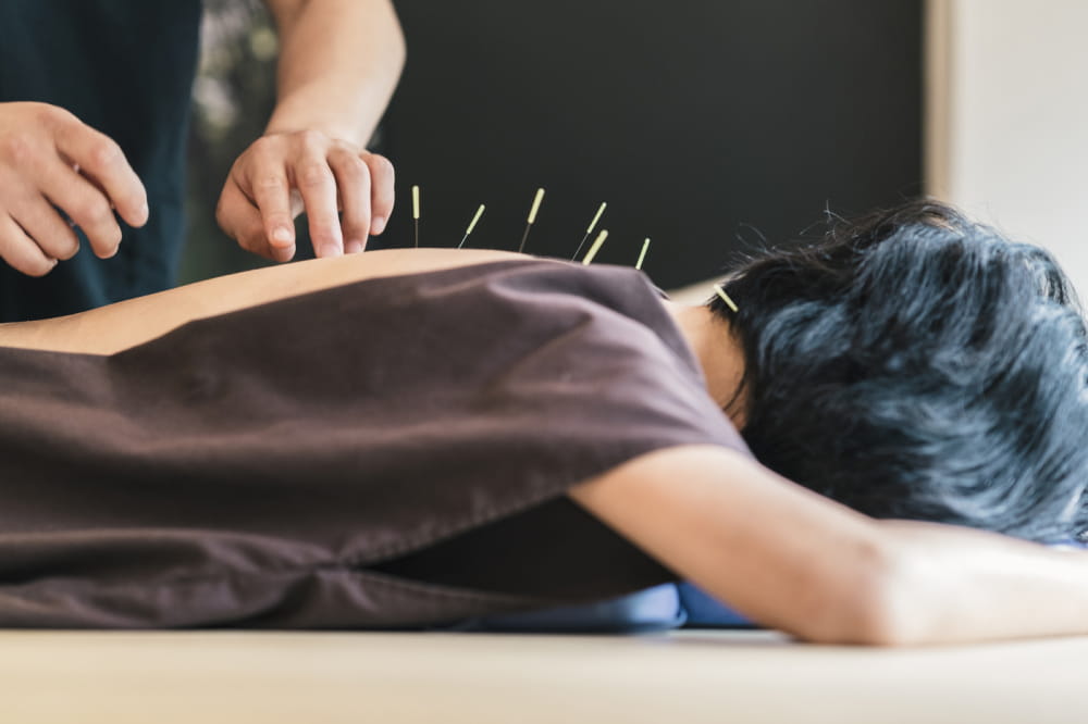 A brief guide to understanding acupuncture