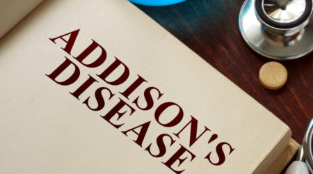 Addison&#8217;s disease &#8211; Causes, symptoms, and management options