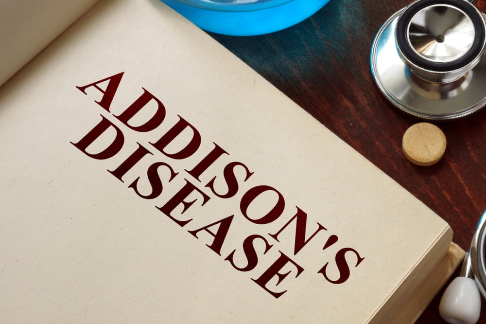 Addison&#8217;s disease &#8211; Causes, symptoms, and management options