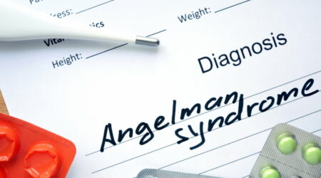 Angelman syndrome &#8211; Signs, causes, and management options